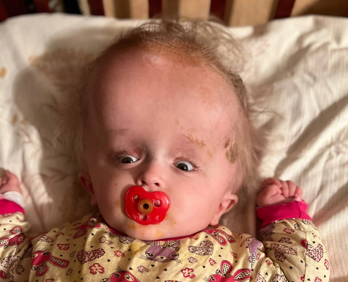 Без операции череп Давида лопнет1677075425