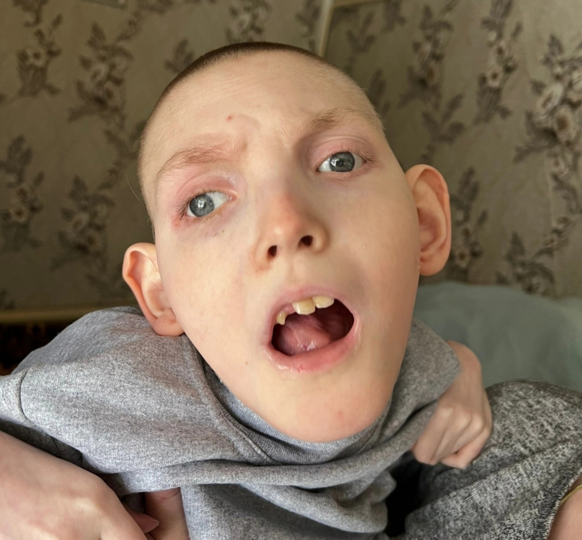 И даже, когда твоя судьба - быть прикованным к кровати. Всё равно есть надежда...1677517642