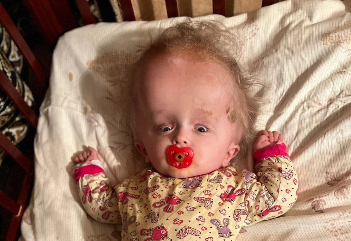 Изменить судьбу Давида и подарить ему жизнь без боли помогли благотворители итальянской ассоциации "Aiutateci a Salvare i Bambini"1678795486