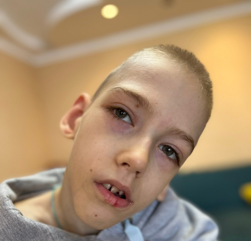 Спасти Никиту от судорог и непрерывной боли может реабилитация1679065156