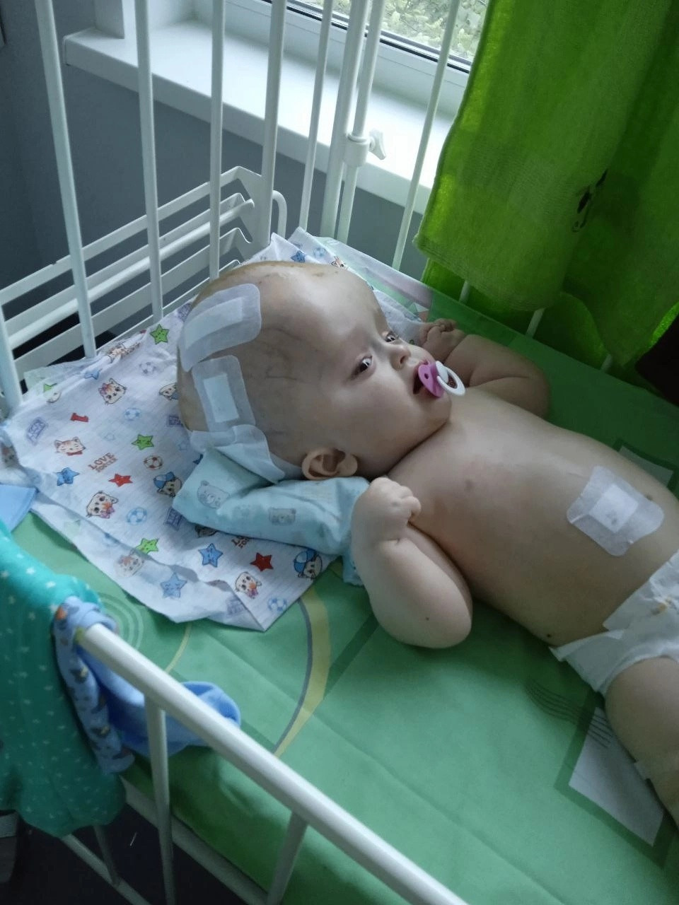 Давидику Панкратову успешно провели спасительную операцию1684497560