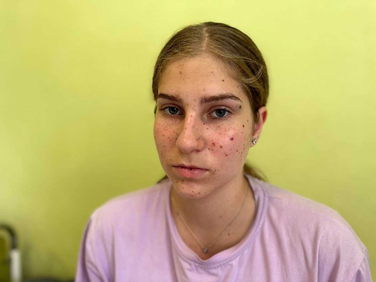 Синяки и кровоподтёки - жизни Кире угрожает пурпура.1693560309