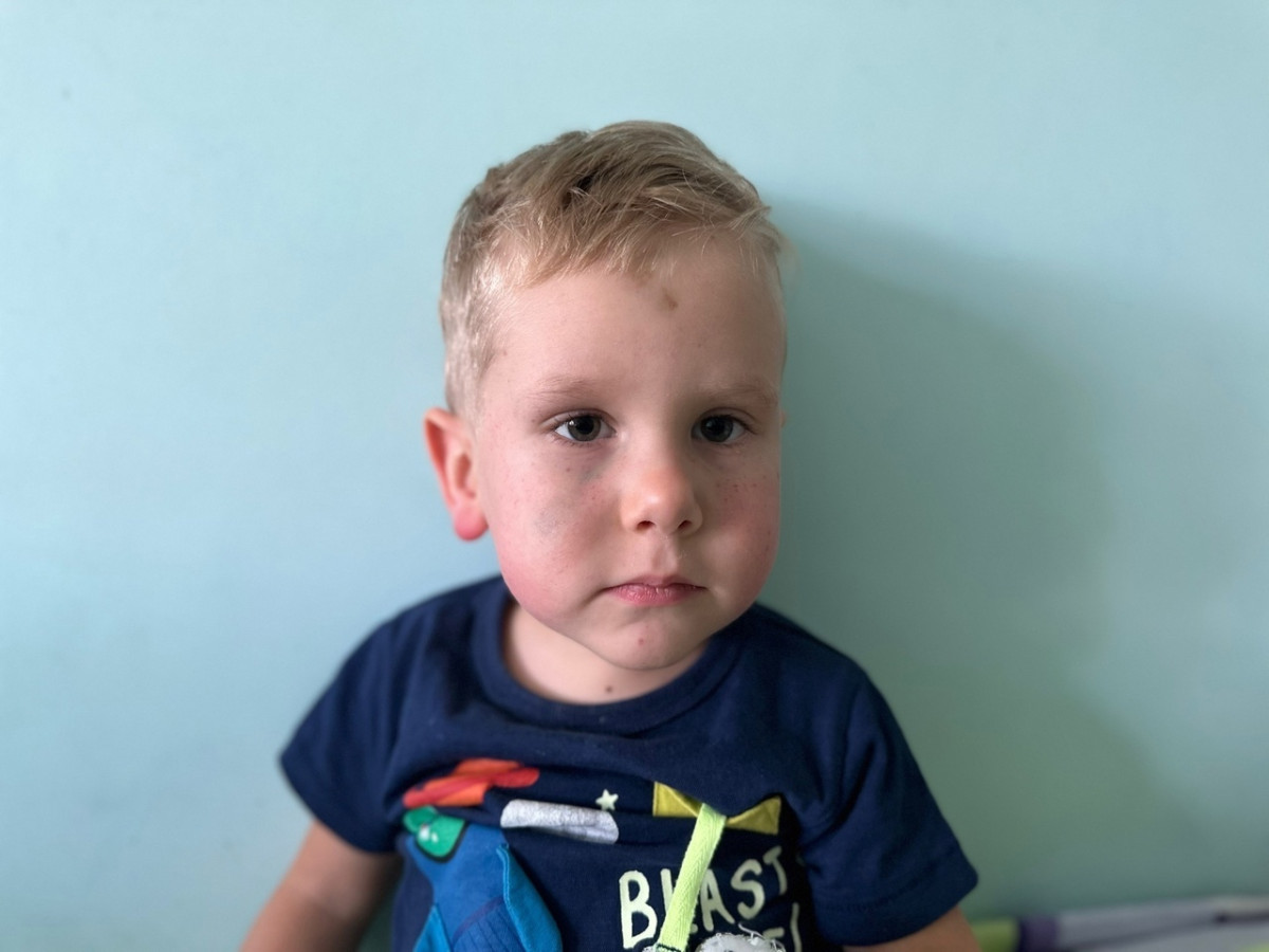 Слезы с примесью крови - Давид едва не погиб от пурпуры.1695027736