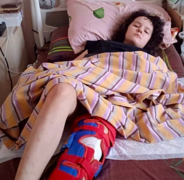 Операция на ножке прошла успешно! Вы спасли Аню от инвалидности1772106689