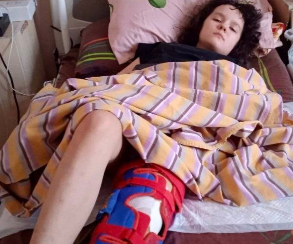 Операция на ножке прошла успешно! Вы спасли Аню от инвалидности1772106689