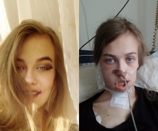 Sofia Sidorova is one of many children whose life was saved thanks to the coordinated work of the Ministry of Health of the DNR, the Russian Ministry of Health, and the Dmitry Rogachev Center in Moscow.1622892249