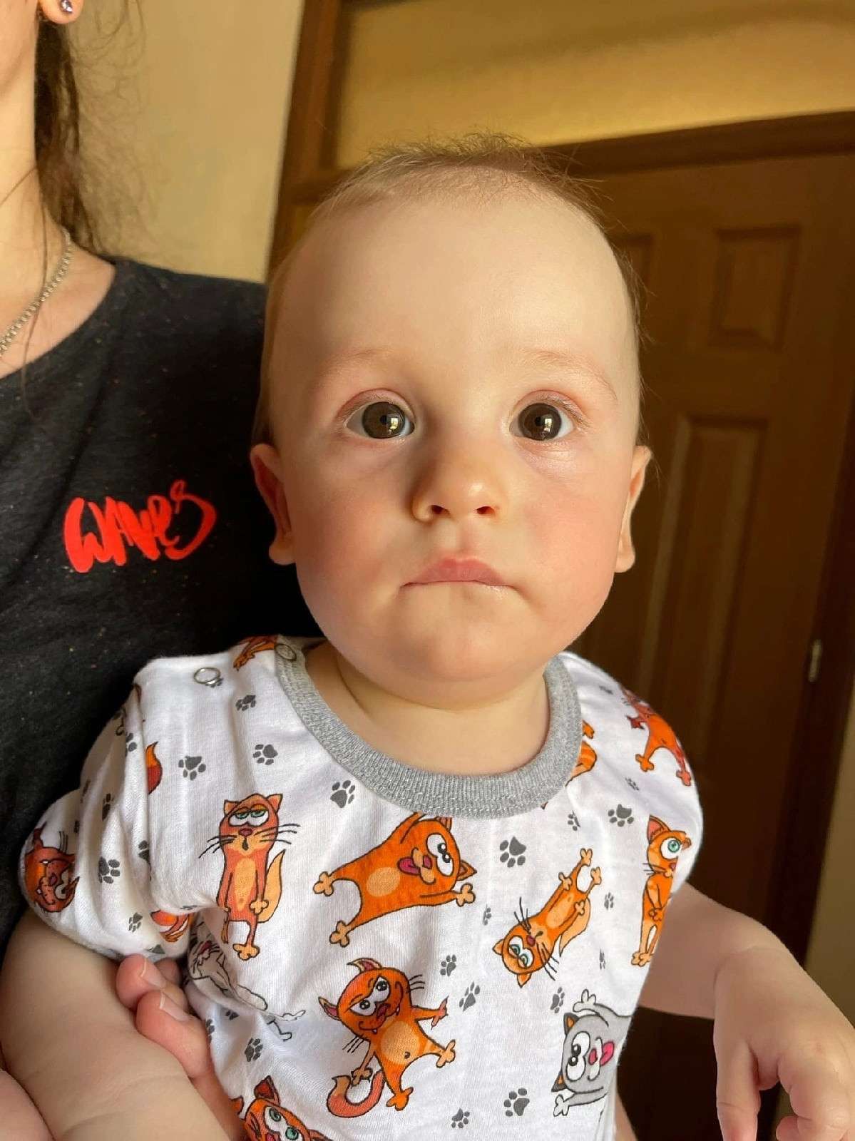 Цитомегаловирус без лечения - это медленная смерть. Постепенно откажут все органы1654103398