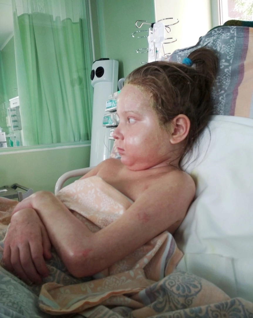 После двух месяцев, проведённых в подвале, с дочки просто начала слезать кожа.1658951710