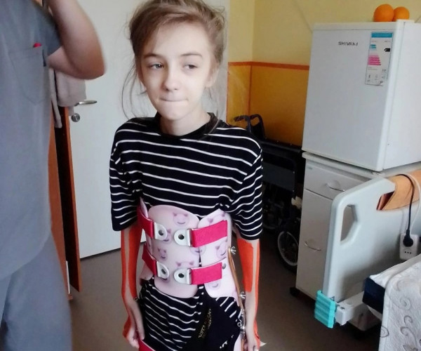 Осколочное ранение навсегда изменило жизнь Полины из Донбасса1673756198